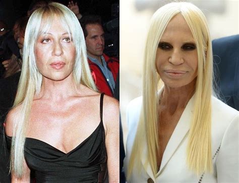 what happened to donatella versace face|donatella versace before and after.